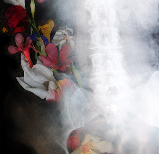 Cloudex Radiology Solutions